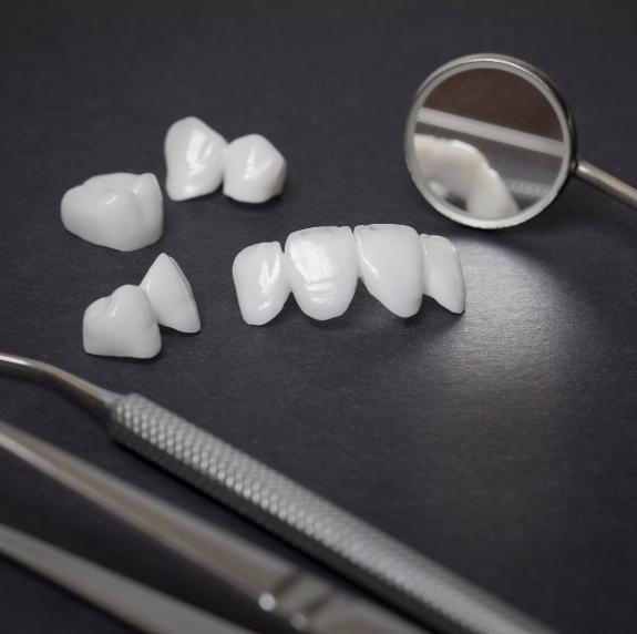 Several white dental crowns and veneers on table next to dental mirror